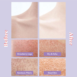[Toi:L] Gentle Touch Bubble Peeling Body Pad (5 Pads)