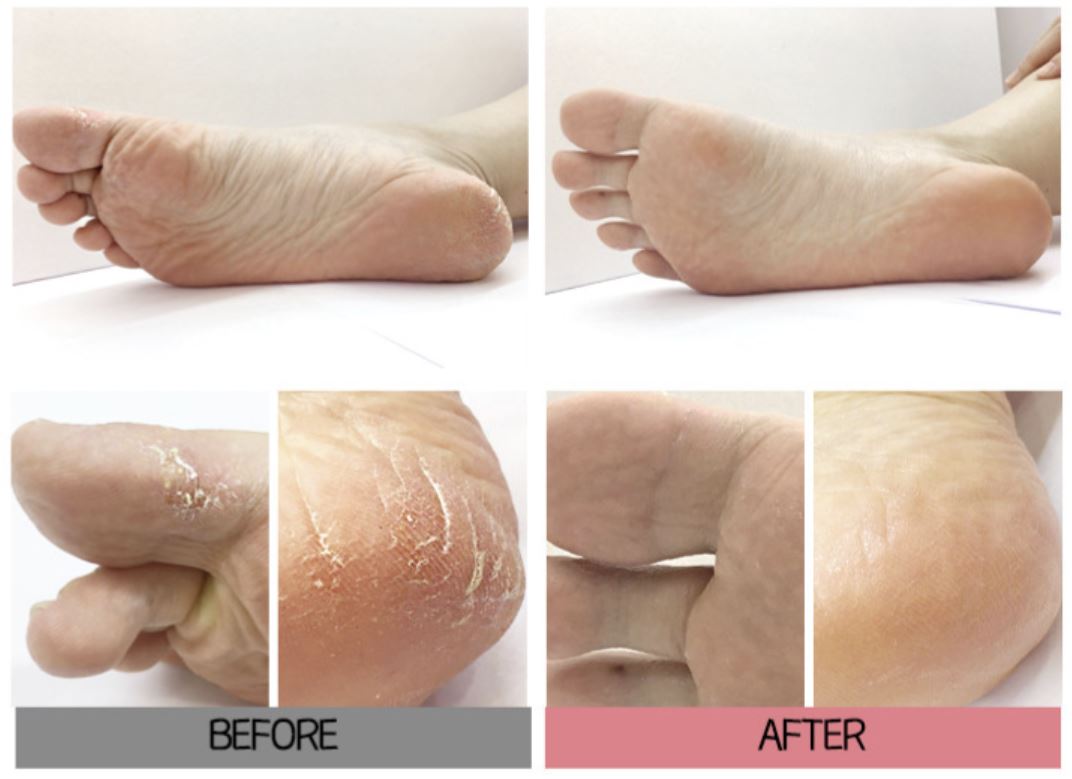 [Holika Holika] Baby Silky Foot One Shot Peel Mask