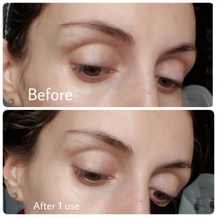 [Benton] Snail Bee Ultimate Hydrogel Eye Patch (30 Pairs) - Fresh Mask Korean Beauty